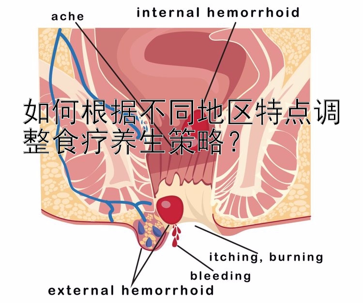 如何根据不同地区特点调整食疗养生策略？